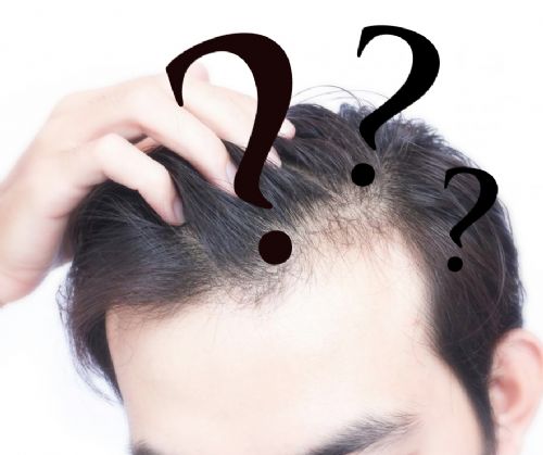 How many hair grafts needed?